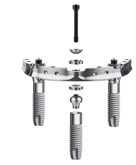 Dientes fijos en 24h con solo 3 implantes