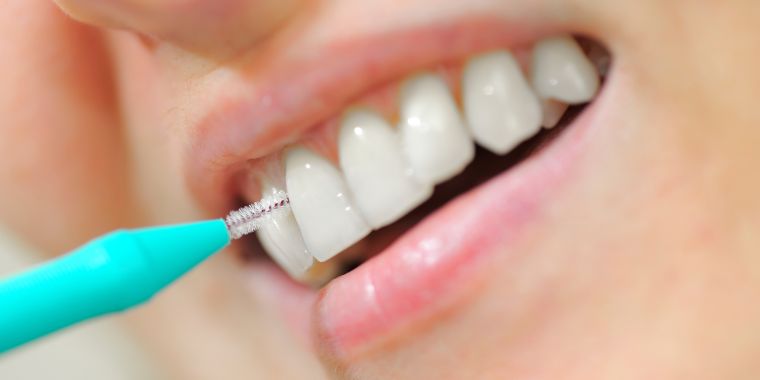  La zona interdental: ¿La tienes en cuenta?