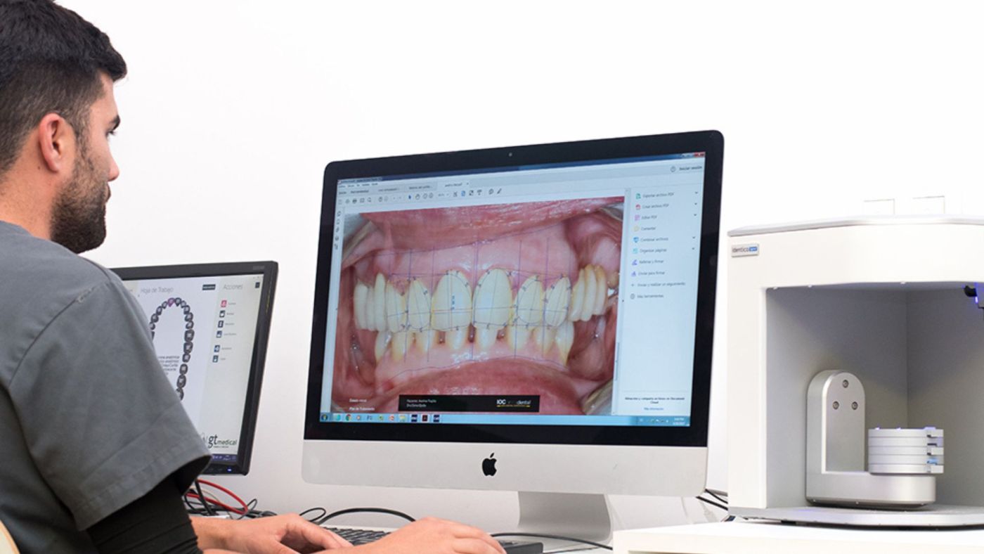 Diseño digitalizado de sonrisas