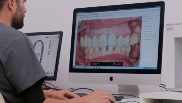 Laboratorio de Prótesis CAD-CAM que trabaja en exclusiva para IOC Clínica Dental