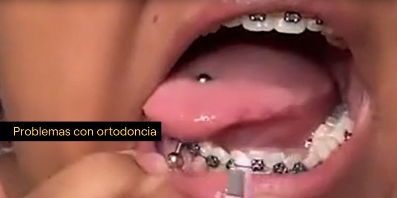 Consecuencias de los piercings orales para la salud bucal