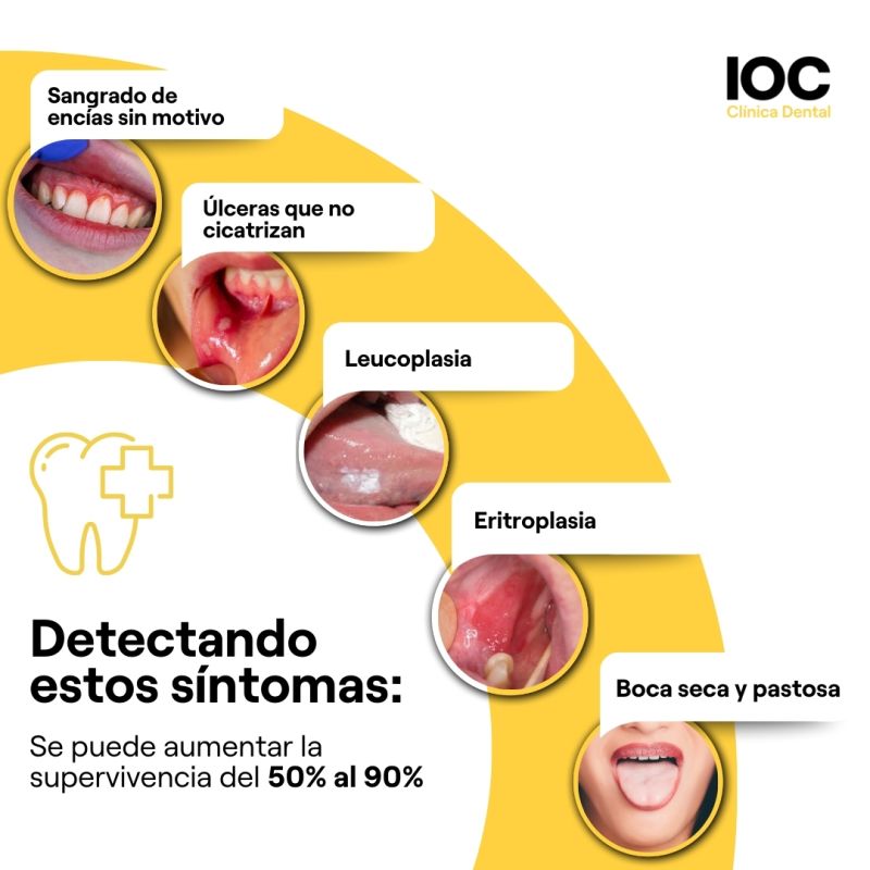 Día Mundial Contra el Cáncer Oral