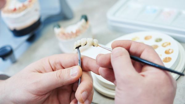 Tipos de Prótesis Dentales en IOC Clínica Dental